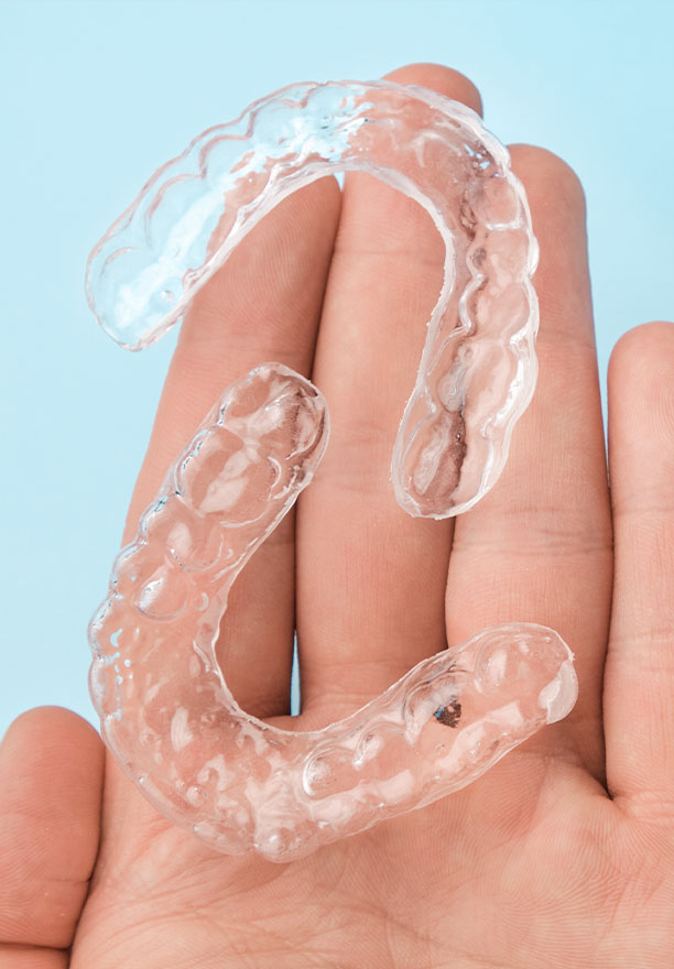 Epident | All-on-4 reg , Periodontal Treatment and Sports Mouthguards