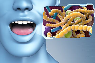 Epident | Preventative Program, Dental Fillings and EpiExams