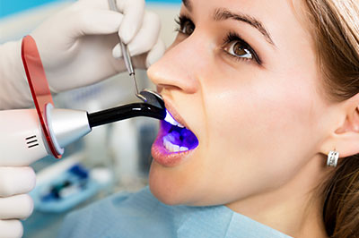 Epident | Crowns, Full Mouth Reconstruction and Implant Restorations