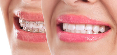 Epident | Sleep Apnea, Root Canals and All-on-4 reg 