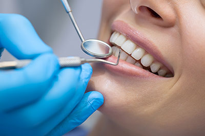 Epident | Sports Mouthguards, Dental Fillings and Periodontal Treatment