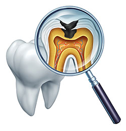 Epident | Cosmetic Dentistry, Dental Bridges and Snoring Appliances