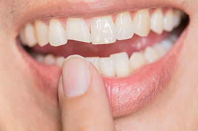 Epident | Laser Dentistry, Cosmetic Dentistry and Full Mouth Reconstruction