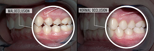 Epident | Fluoride Treatment, CBCT and Dental Fillings