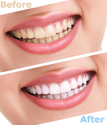 Epident | EpiExams, Extractions and All-on-4 reg 