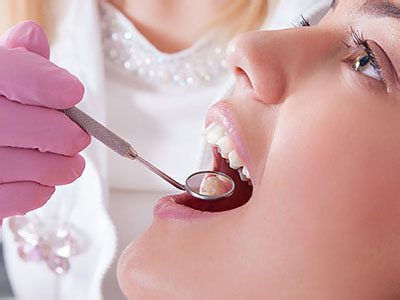 Epident | Oral Cancer Screening, Fluoride Treatment and EpiCleaning