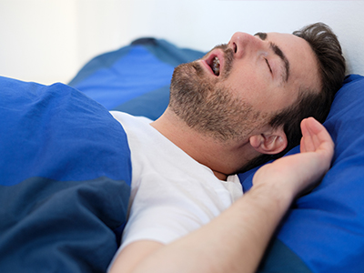 Epident | All-on-6 reg , Sleep Apnea and Extractions